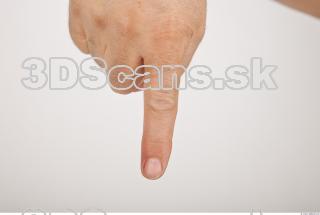 Photo reference of finger 0003